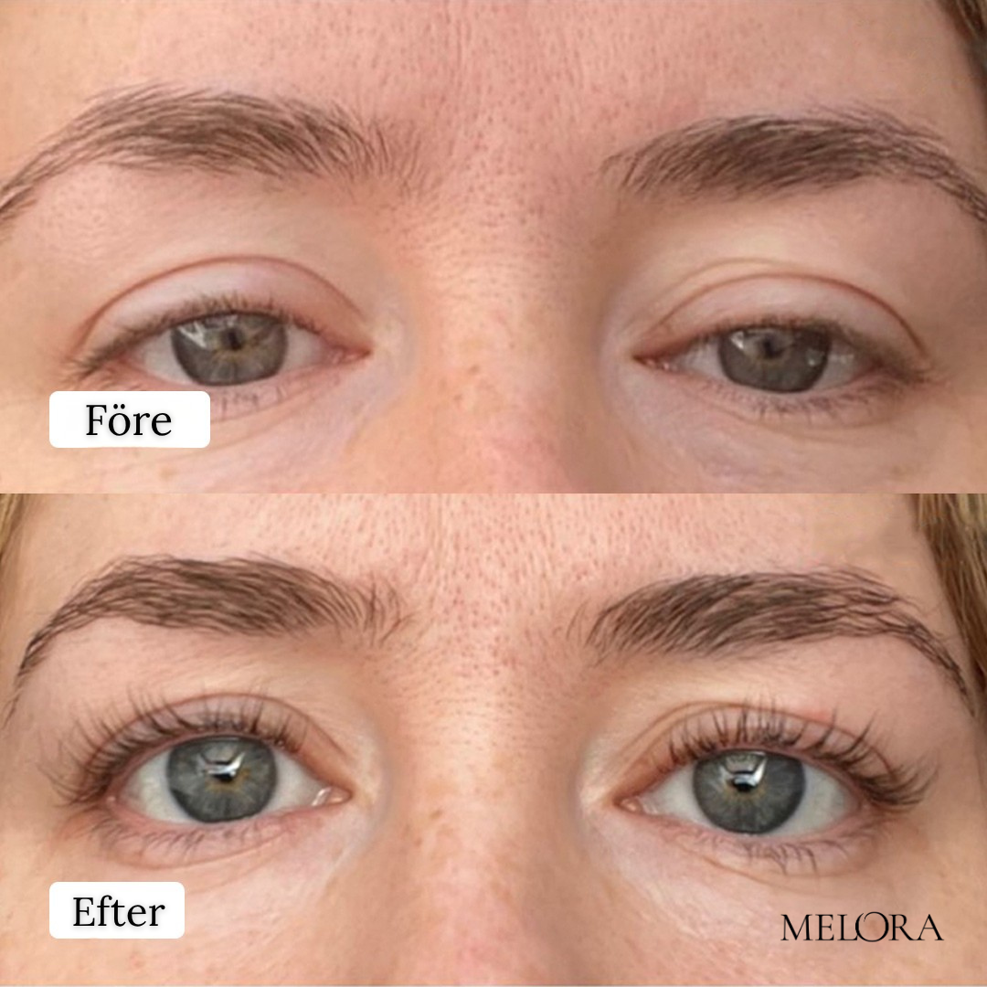 Biopeptid-serum for øyenvippevekst