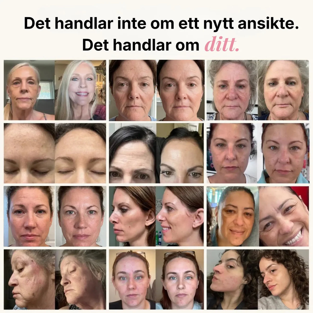 PDRN Kollagen Volumbalsam