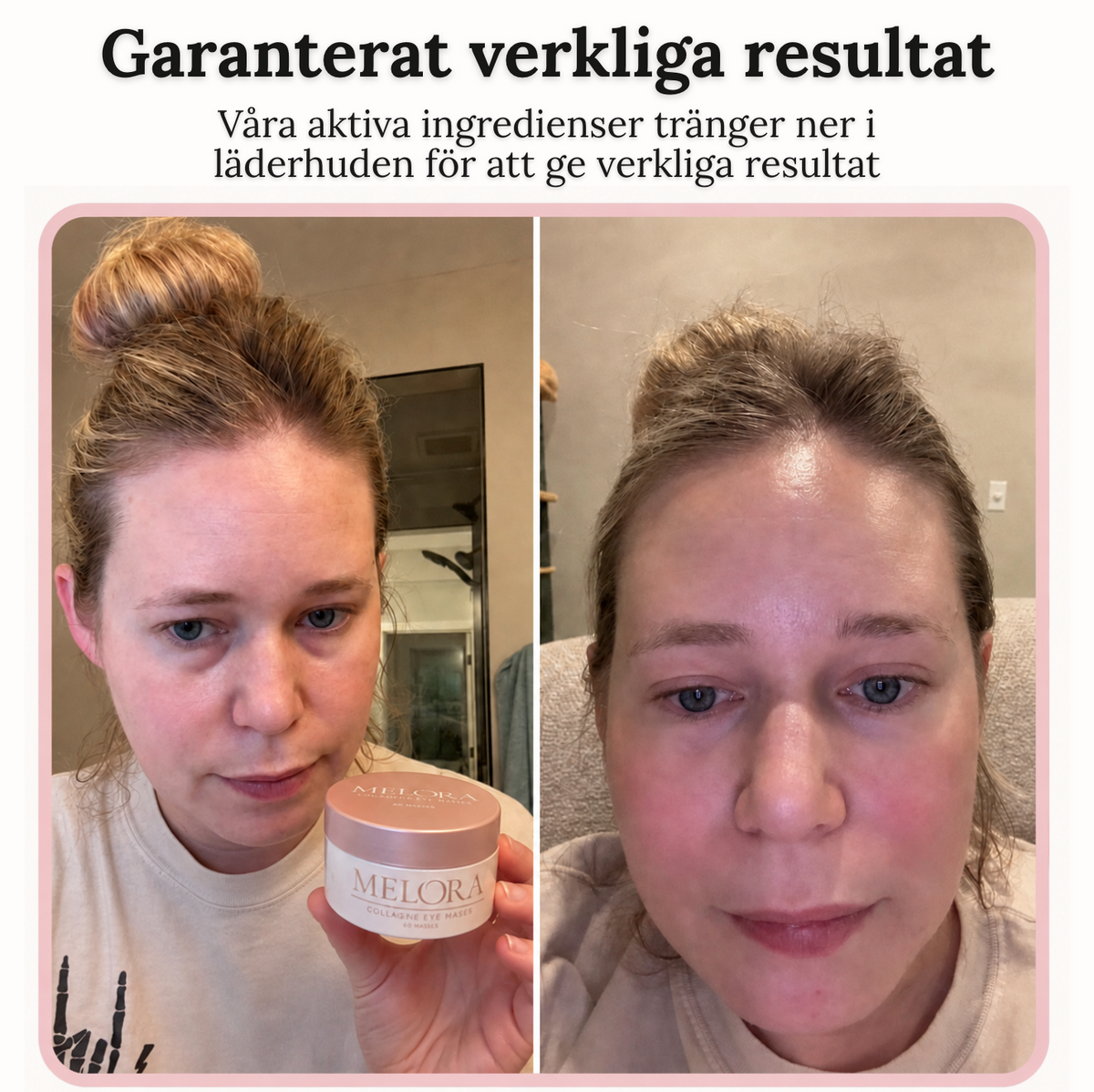 Kollagen-øyemasker, 60 stk.